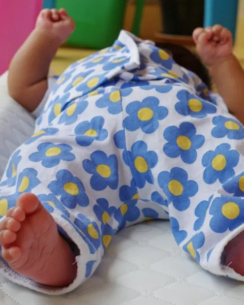 Little Star Yellow Baby Romper - Easy Wear for Busy Kids
